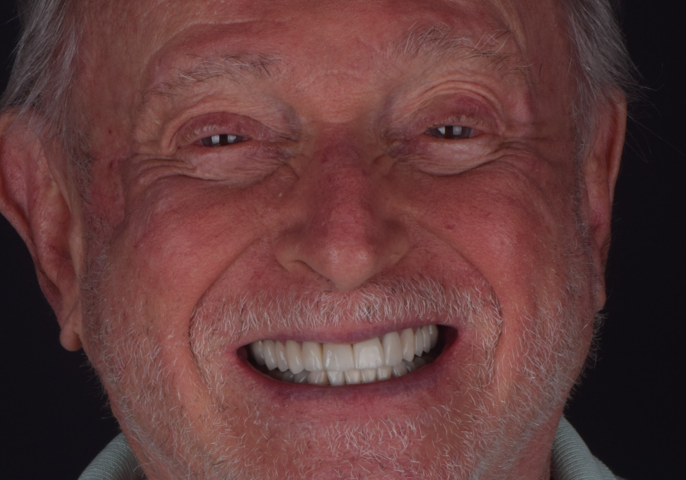 0 - Dentistas em Porto Alegre - Especialista em Implantes Dentários em Porto Alegre - Doutor Roberto Suzuki - Dentes em POA - img 04